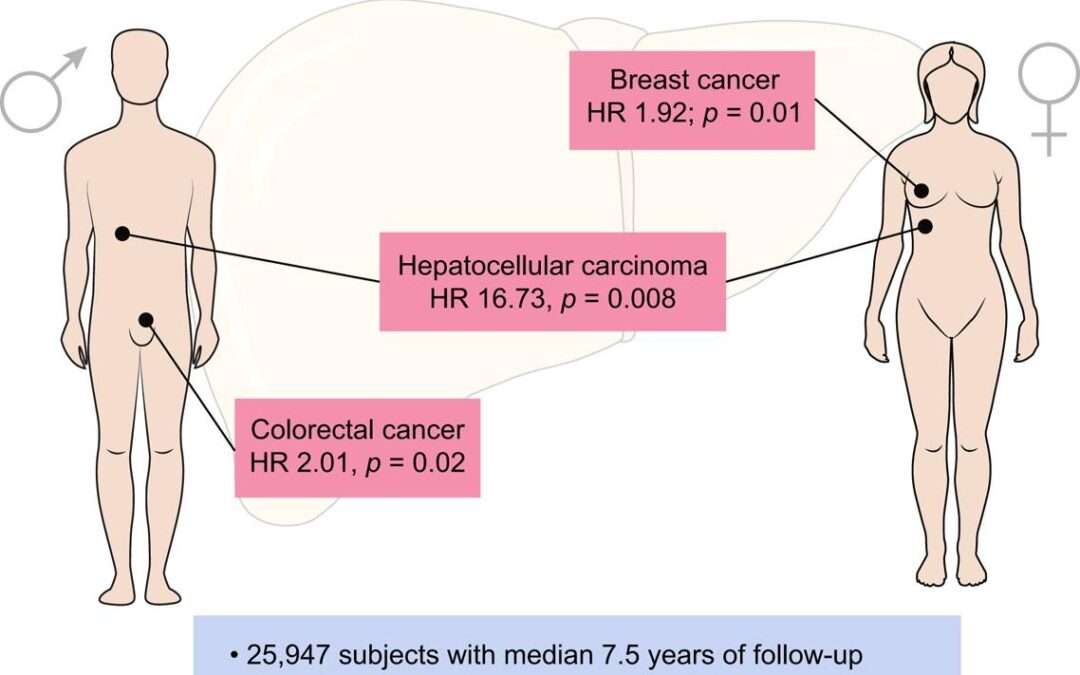 Associazione fra la steatosi epatica non alcolica (NAFLD) e lo sviluppo di alcuni carcinomi