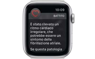 Con Apple Watch serie 4 è possibile fare un tracciato ECG